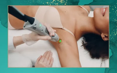 Épilation laser à Genève : expertise, sécurité et technologie médicale