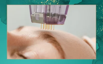 Traitement des cicatrices à Genève : retrouver une peau plus lisse et uniforme